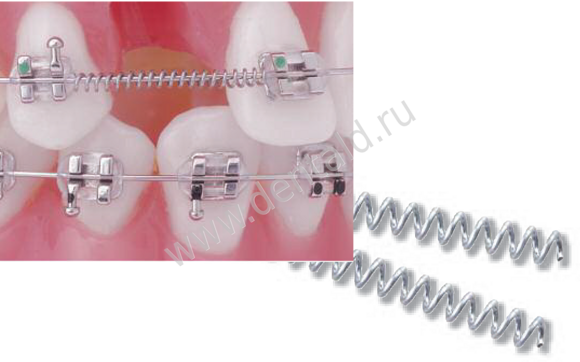 niti-open-coil-springs