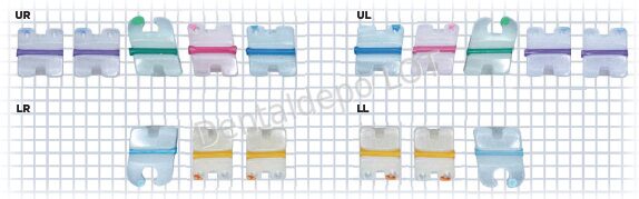 Mystique® MB Kits